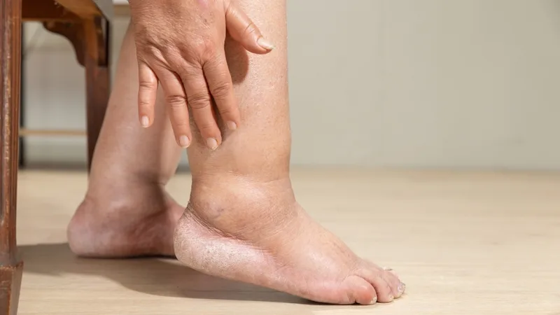 Dấu hiệu suy thận nữ