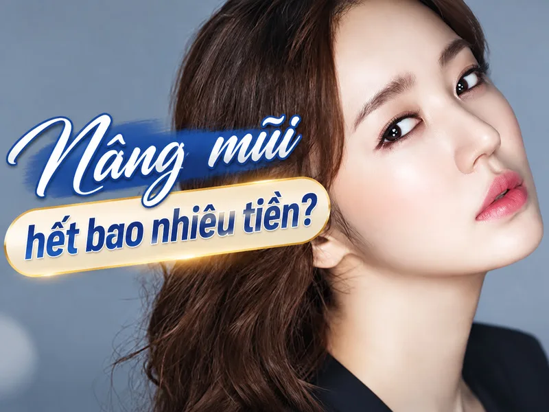 Nâng mũi hết bao nhiêu tiền? Dự trù chi phí trước khi làm